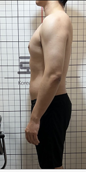 -10kg 사례 복용 후 사진