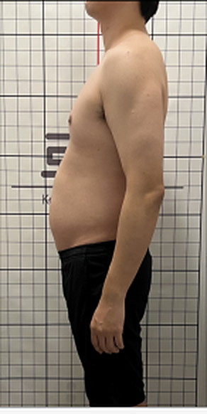 -10kg 사례 복용 전 사진