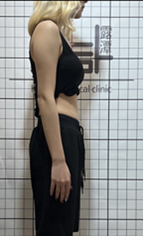-3kg 사례 복용 후 사진
