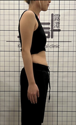 -3kg 사례 복용 전 사진