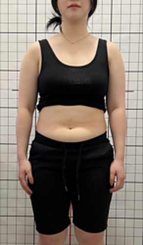 -6kg 사례 복용 전 사진